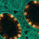 A transmission electron micrograph of SARS-CoV-2 virus particles (in gold) within endosomes of a heavily infected nasal olfactory epithelial cell.